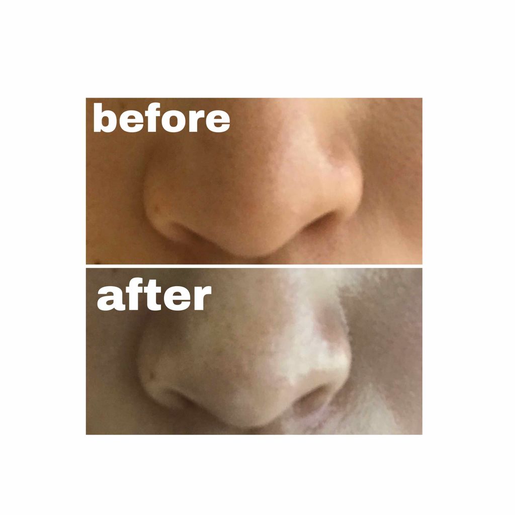 お米のマスク/毛穴撫子/シートマスク・パックを使ったクチコミ(3枚目)