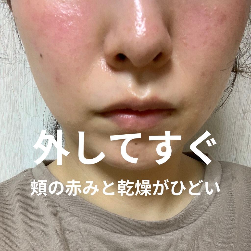 マスク用フィットシート/ランリーゼ/マスクを使ったクチコミ(5枚目)