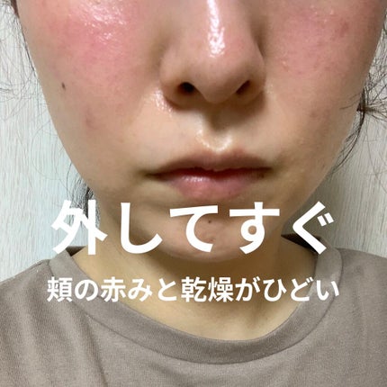 マスク用フィットシート/ランリーゼ/マスクを使ったクチコミ(5枚目)