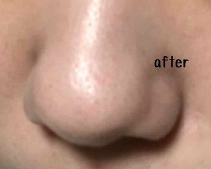 ホホバオイル/無印良品/ボディオイルを使ったクチコミ(3枚目)