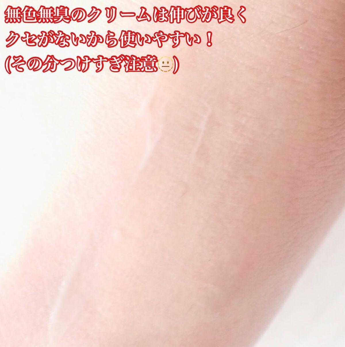 レチノール0.1%クリーム/Frankly/フェイスクリームを使ったクチコミ(5枚目)