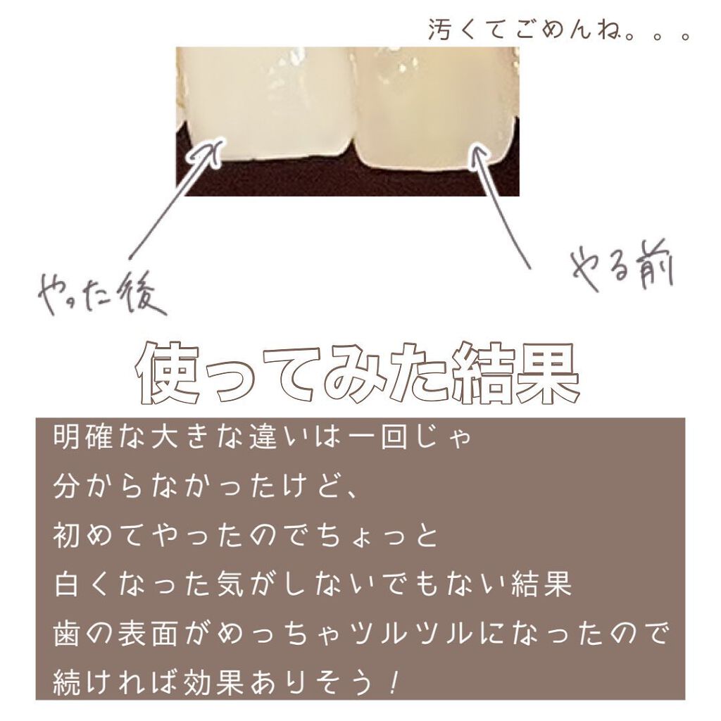 歯を白くするキューブスポンジ/セリア/その他オーラルケアを使ったクチコミ(6枚目)