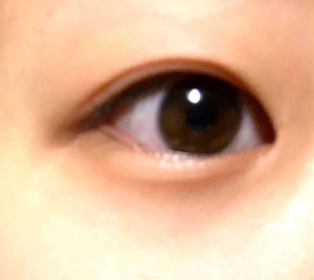 湘南美容アイリッドテープ両面/湘南美容/二重まぶた用アイテムを使ったクチコミ(2枚目)