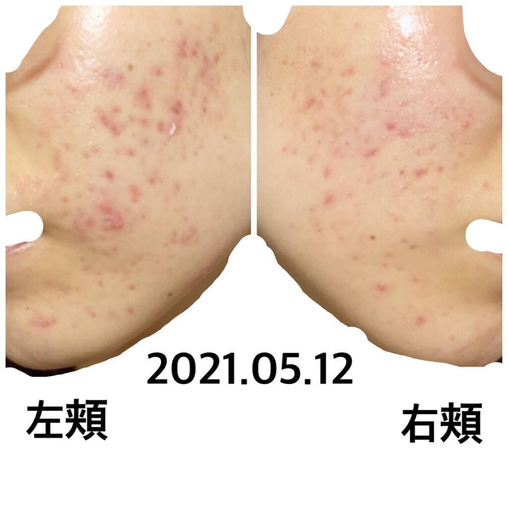 フレッシュリージュースドビタミンドロップ(35ml)/Klairs/美容液を使ったクチコミ(1枚目)