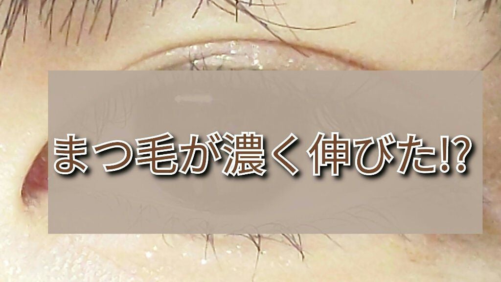 ローヤルゼリー配合 栄養ローション/DAISO/美容液を使ったクチコミ(1枚目)