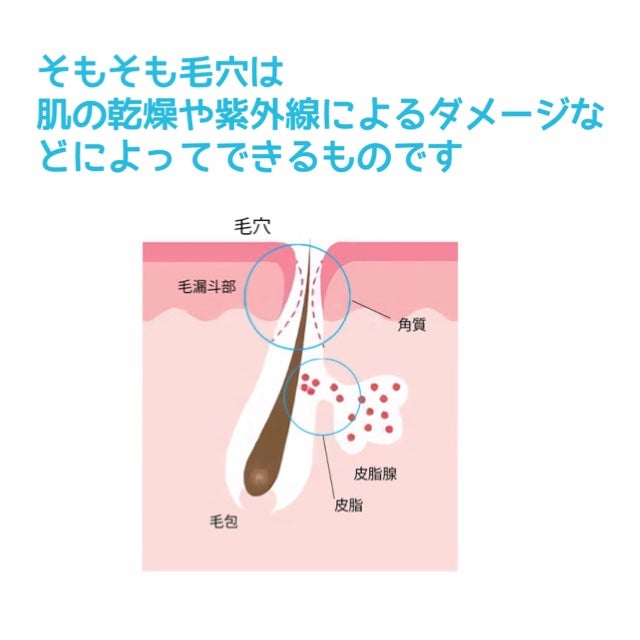 ゼロ毛穴クレイパック/MEDICUBE/洗い流すパック・マスクを使ったクチコミ(2枚目)