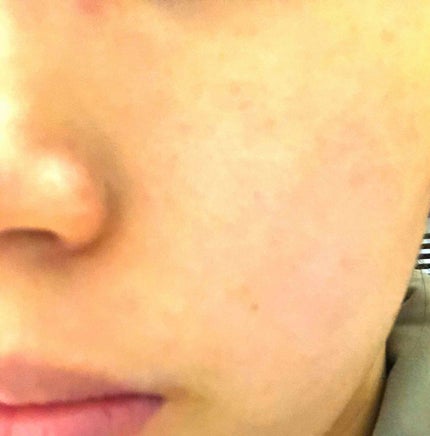 濃い美容液/レシピスト/美容液を使ったクチコミ(4枚目)