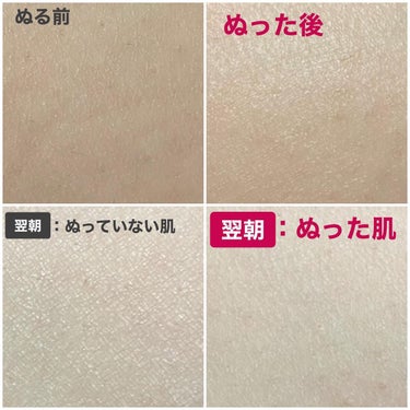 ノルウェー フォーミュラ インテンスリペア CICAボディエマルジョン/Neutrogena/ボディローションを使ったクチコミ（3枚目）