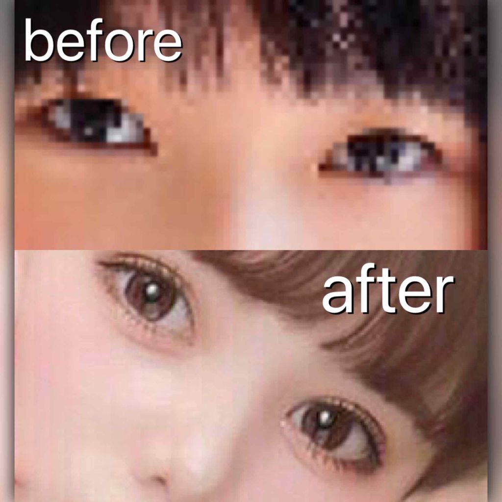 アクティブアイトークII/アイトーク/二重まぶた用アイテムを使ったクチコミ（1枚目）