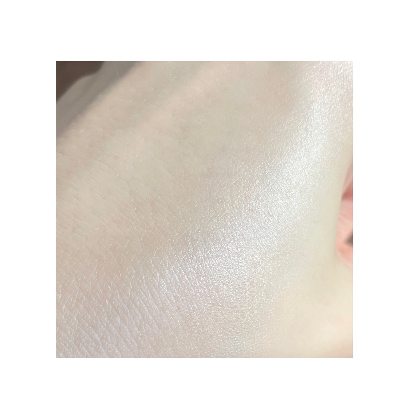 エファクラ ピールケア セラム/ラ ロッシュ ポゼ/美容液を使ったクチコミ(5枚目)