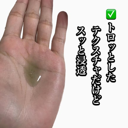 アクネウォッシュ23アンプル/Feld Apotheke/美容液を使ったクチコミ(3枚目)