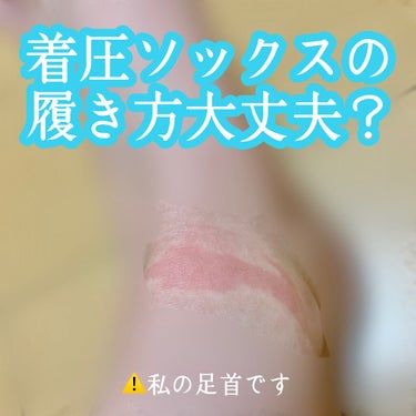 수아で〜す🦋

今日はダイエットしてる人ならほぼ持ってる『着圧ソックス着用する時の注意しないといけない事』を紹介します、、、😭😭


沢山歩いた時、浮腫んでいるなと思った時によく、着圧ソックスを使用する