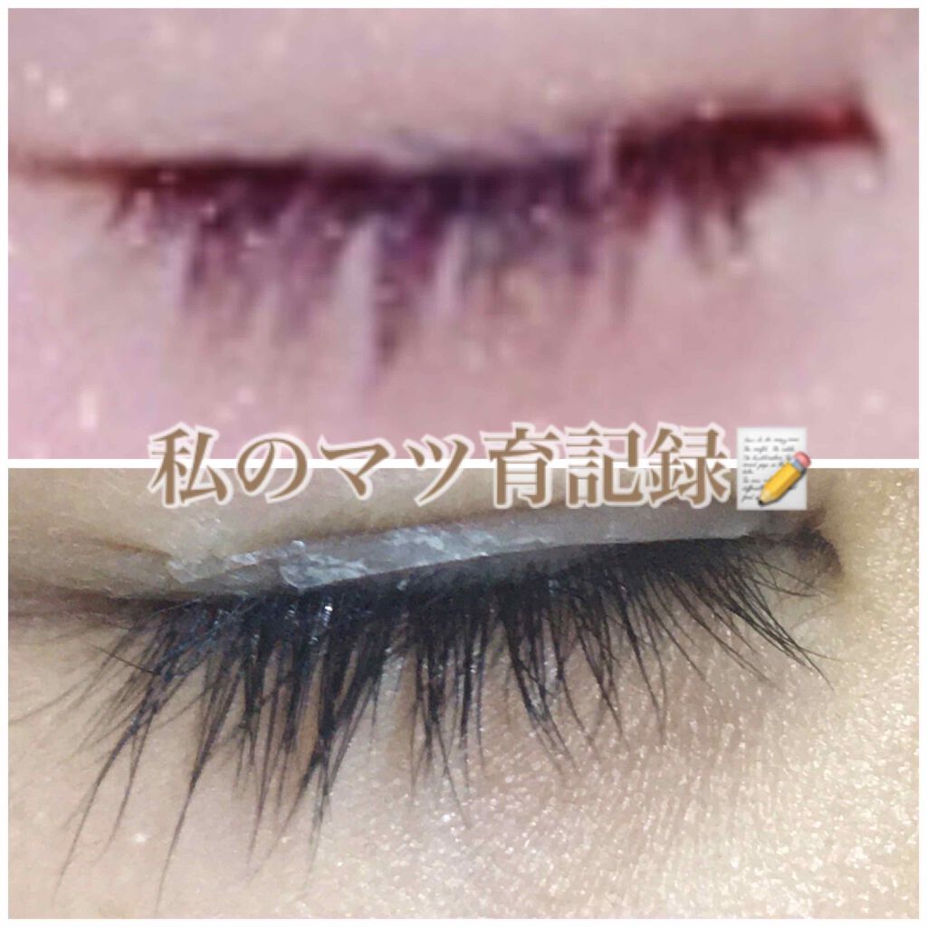 オリジナル ピュアスキンジェリー/ヴァセリン/ボディクリームを使ったクチコミ（1枚目）