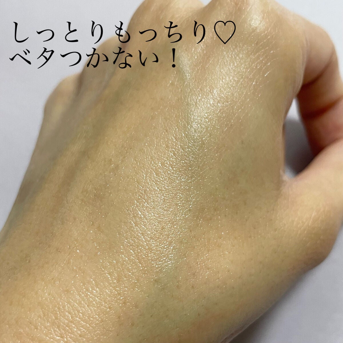 ウォータードロップスージングクリーム/Acne Cat/フェイスクリームを使ったクチコミ(3枚目)