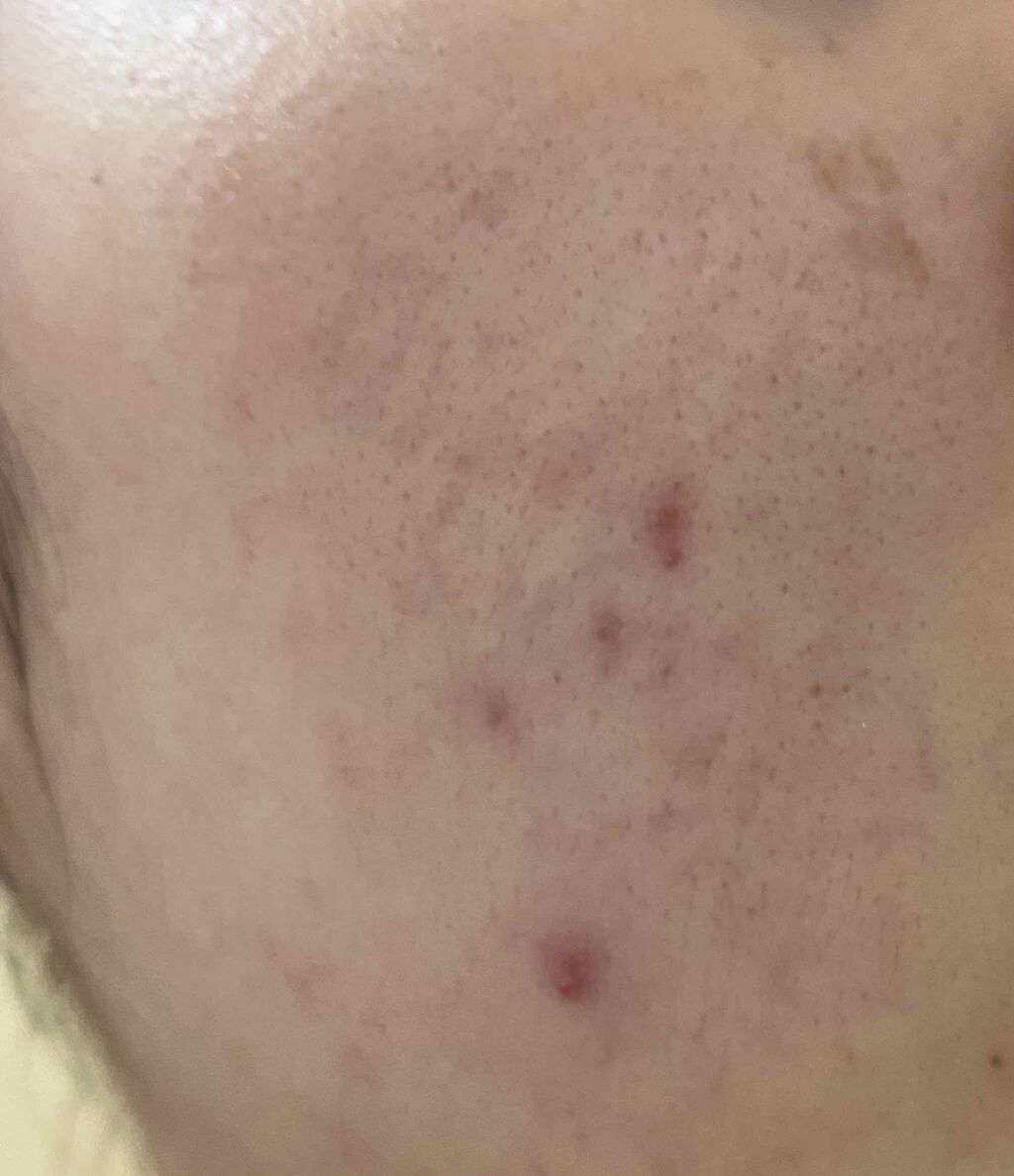 Cセラム/b.glen/美容液を使ったクチコミ（2枚目）