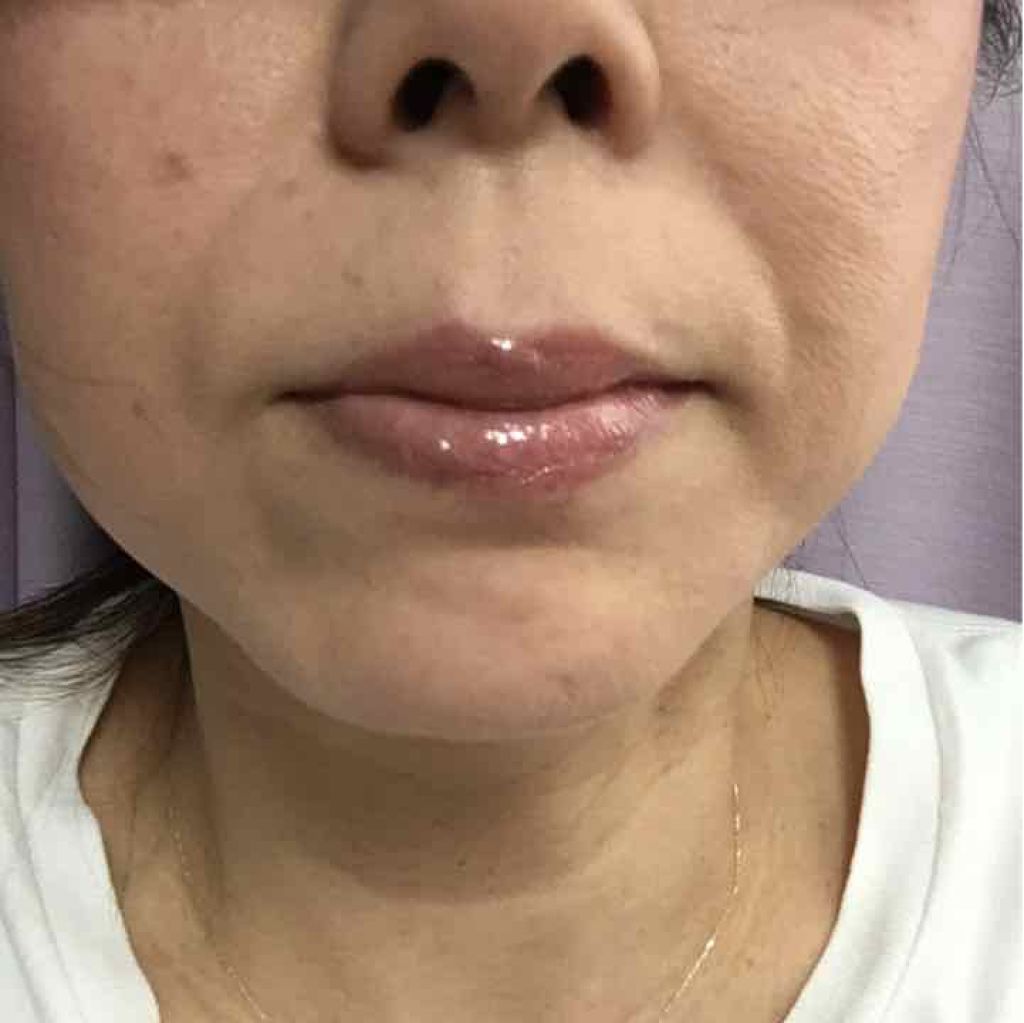 エッセンスジェルルージュ/マキアージュ/リップグロスを使ったクチコミ（2枚目）