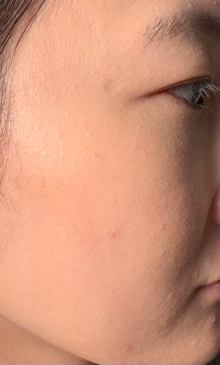 ピンクティーツリーカバークッション/APLIN/クッションファンデーションを使ったクチコミ(10枚目)