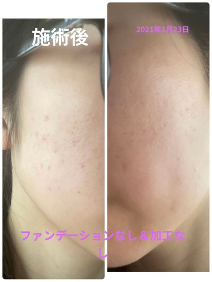 レ キャトル オンブル/CHANEL/アイシャドウパレットを使ったクチコミ(8枚目)