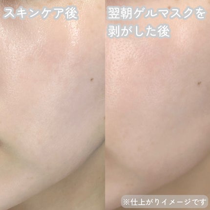 PDRN ハイドロゲルマスク/VT/シートマスク・パックを使ったクチコミ(4枚目)