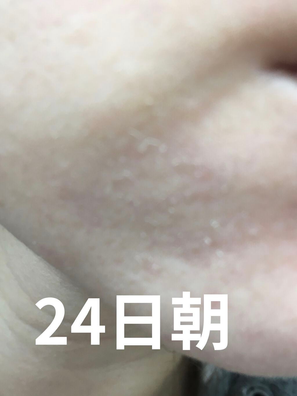 レチノールA 1% アドバンスドリバイタリゼーションクリーム/Life-flo/フェイスクリームを使ったクチコミ(4枚目)