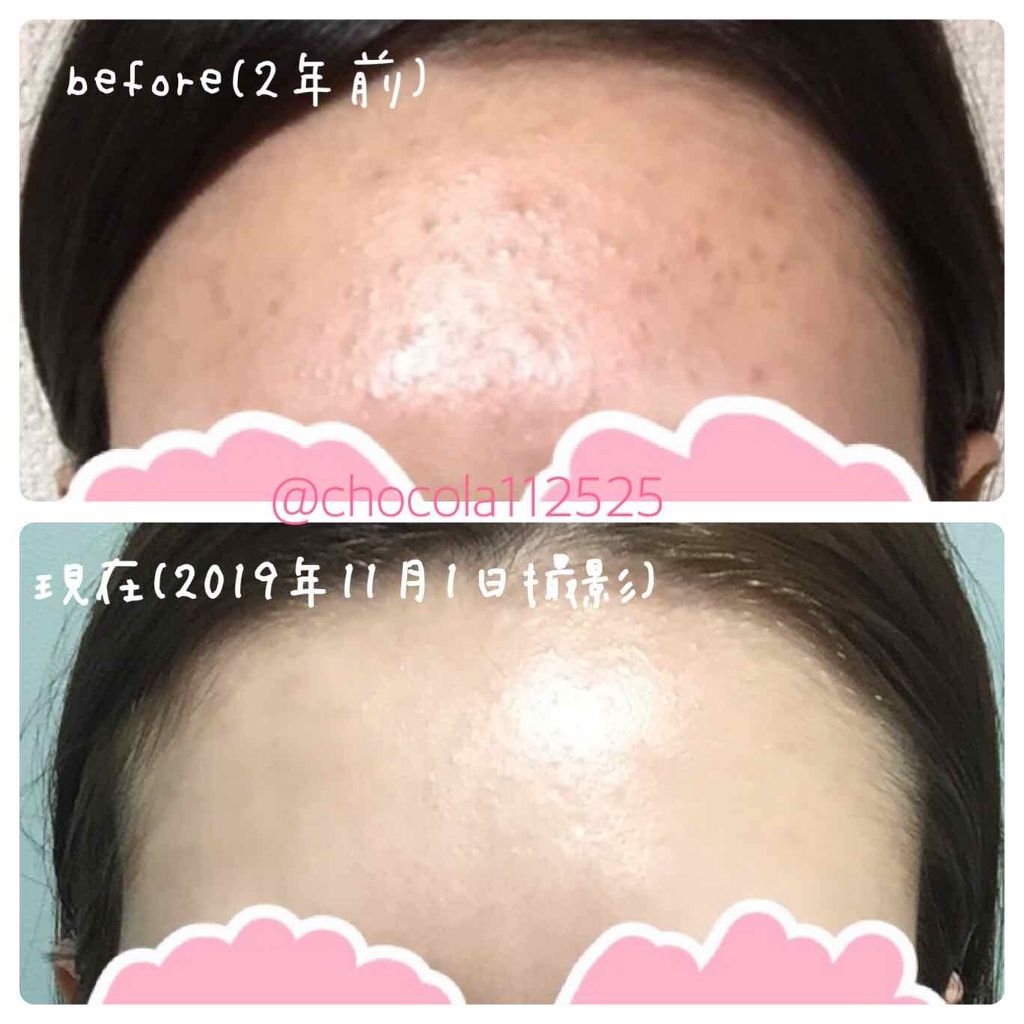 ロゼット 洗顔パスタ 白泥リフト/ロゼット/洗顔フォームを使ったクチコミ(1枚目)