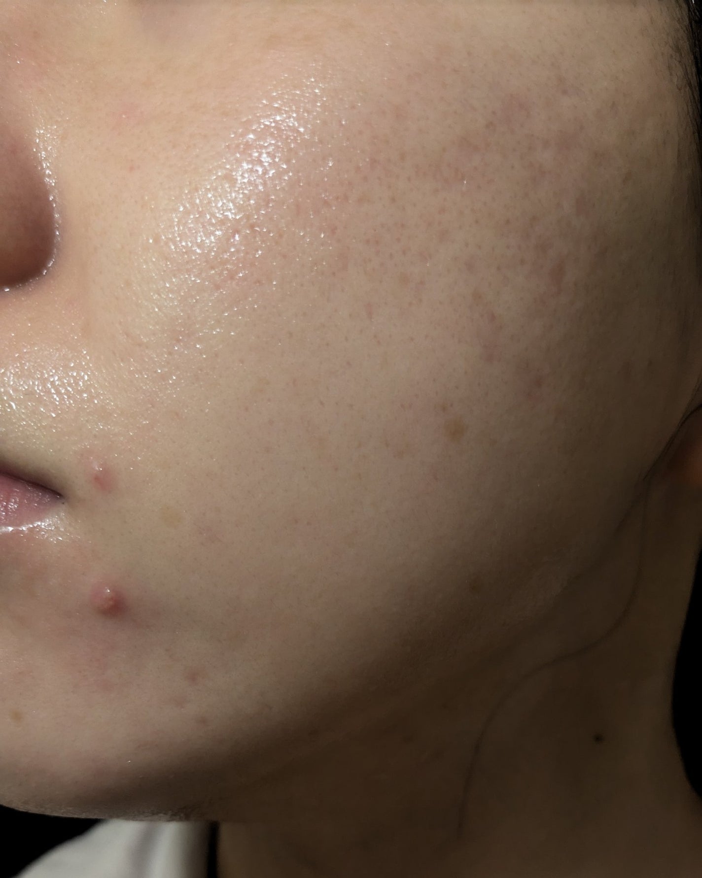 miina@汚肌工事録⚠️ on LIPS 「10/24の#汚肌工事録💐肌がのためにやっていること💊乳酸菌や..」(2枚目)