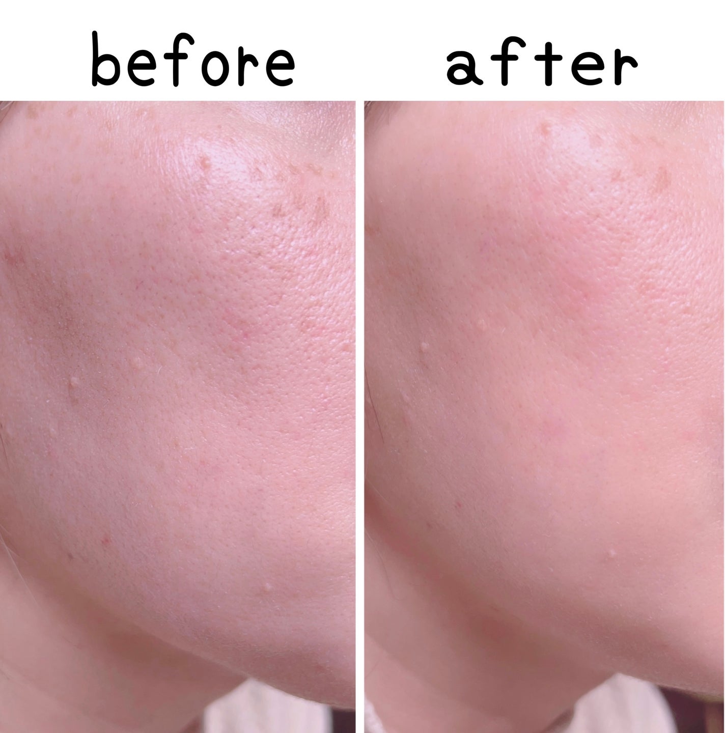 コラーゲンモイスチャーカラーコントロール/illuN/化粧下地を使ったクチコミ(5枚目)