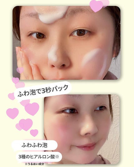 lala on LIPS 「☁3種のヒアルロン酸*1配合の濃密泡!☁スキンケアしながら洗顔..」(4枚目)