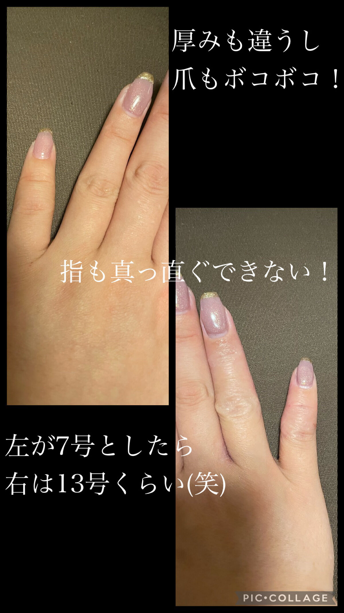 リンデロンVs軟膏（医薬品）/シオノギ製薬/その他を使ったクチコミ（2枚目）