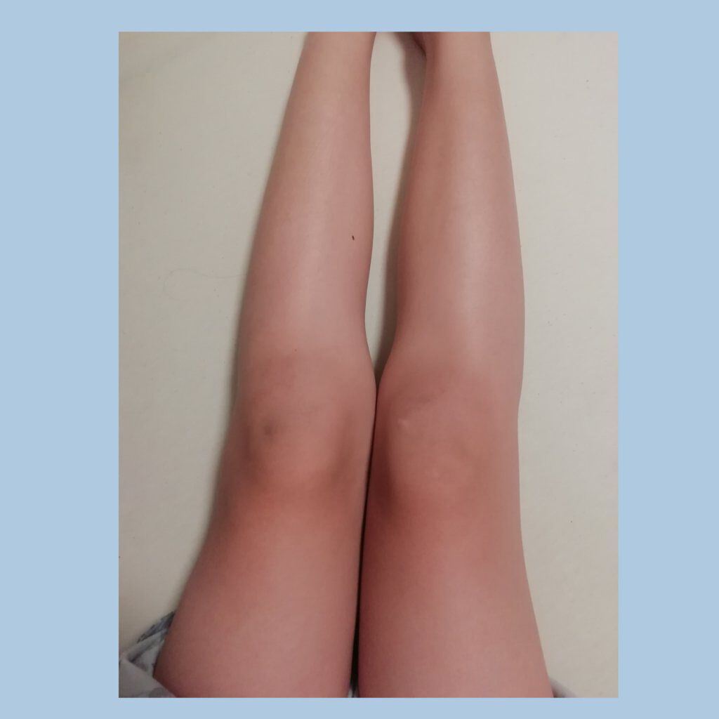 ビタミンC MIX/Dear-Natura (ディアナチュラ)/美容サプリメントを使ったクチコミ（2枚目）