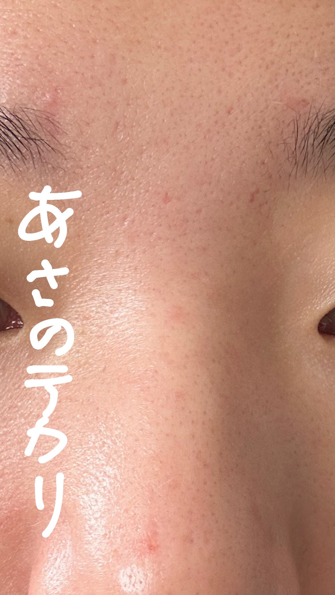 カラミー カラミンノーセバムローション/Calamee/化粧水を使ったクチコミ(3枚目)