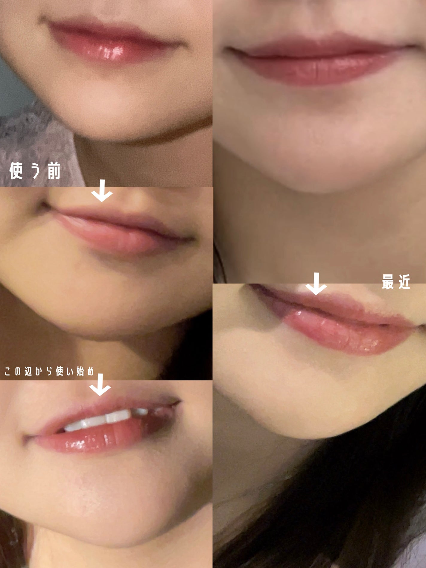 白潤 薬用美白化粧水(しっとりタイプ)/肌ラボ/化粧水を使ったクチコミ(2枚目)