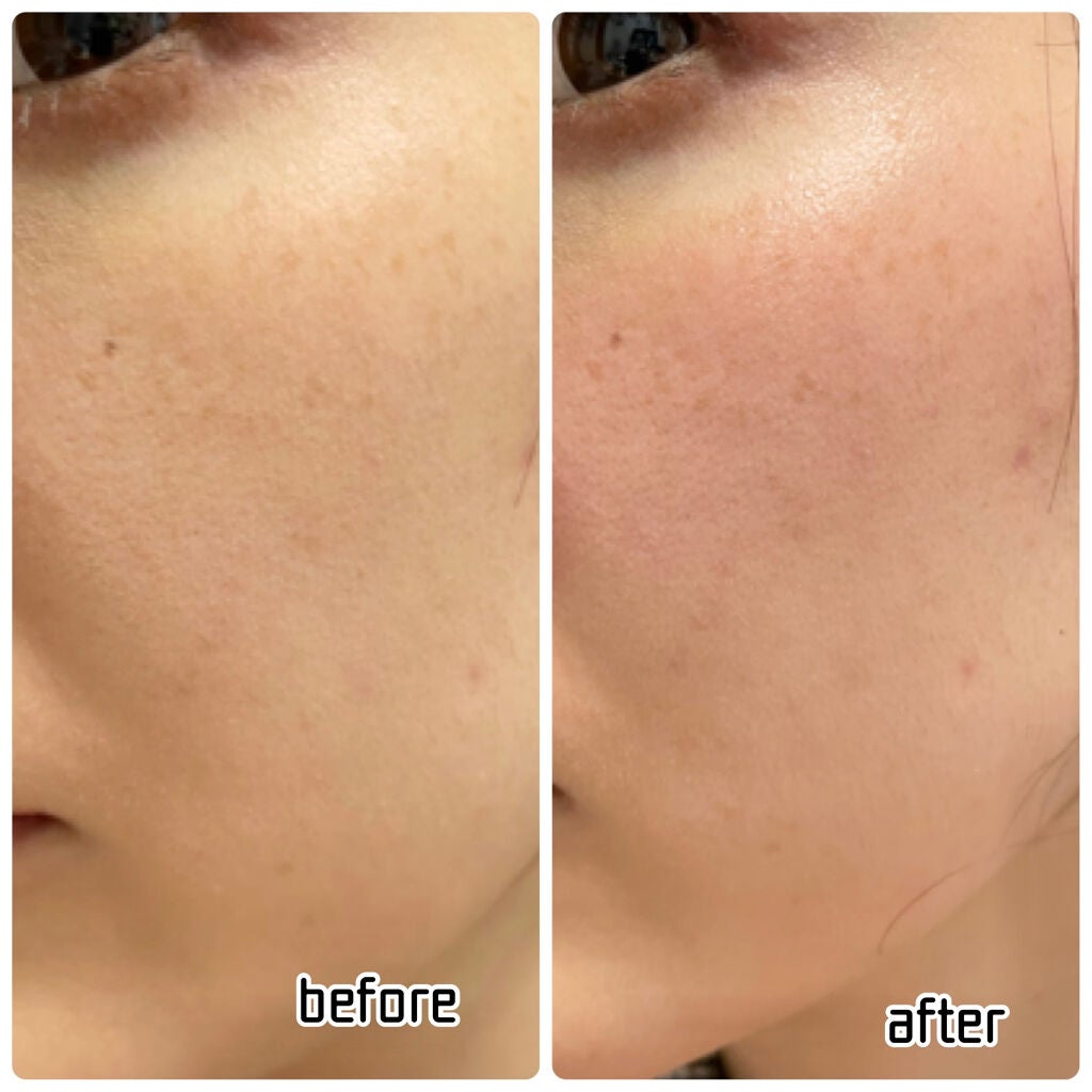 チーク ティント <ウォータリーチーク>/ADDICTION/リキッドチークを使ったクチコミ(5枚目)