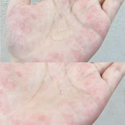 ガラクナイアシン2.0エッセンス/manyo/美容液を使ったクチコミ(4枚目)