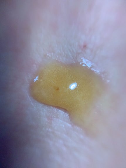 じわっと温感リップスクラブ/DAISO/リップグロスを使ったクチコミ(4枚目)