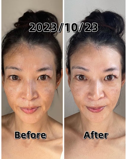 エクスイディアル オーヴォ/エクスイディアル/美顔器・マッサージを使ったクチコミ(5枚目)