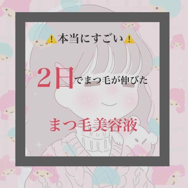 ⚠️まつ毛が2日で伸びる⚠️(しかもワンコイン)


~早く効果が欲しい人にとってもオススメするまつ毛美容液~




こんにちは!!ﾎﾉｶです！

最近、私はまつげが短い＆少ないことに気づき、まつげ美