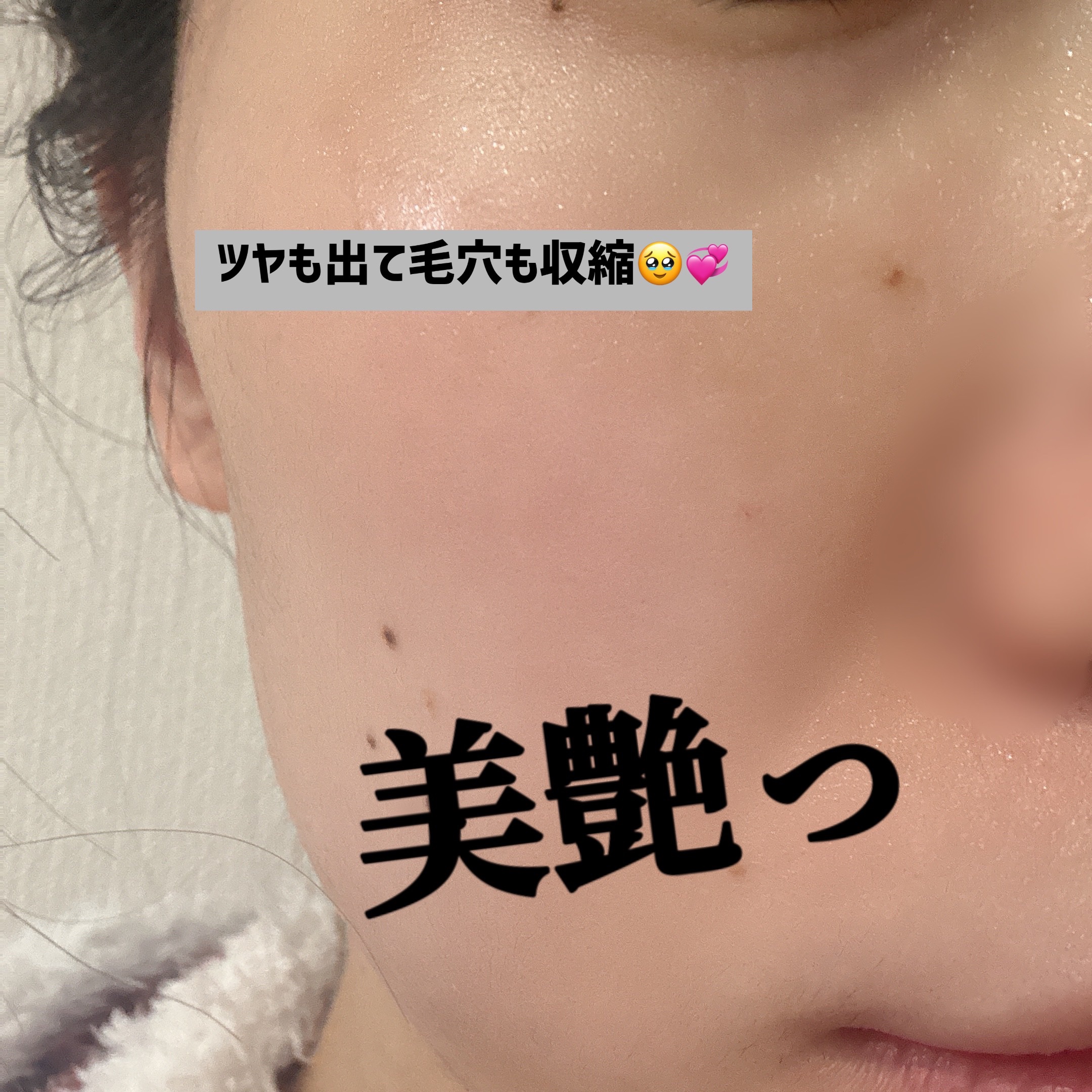 ダーマシナジーラッピングマスク毛穴ハリ（レチノール×LHA）/MEDIHEAL/シートマスク・パックを使ったクチコミ（3枚目）