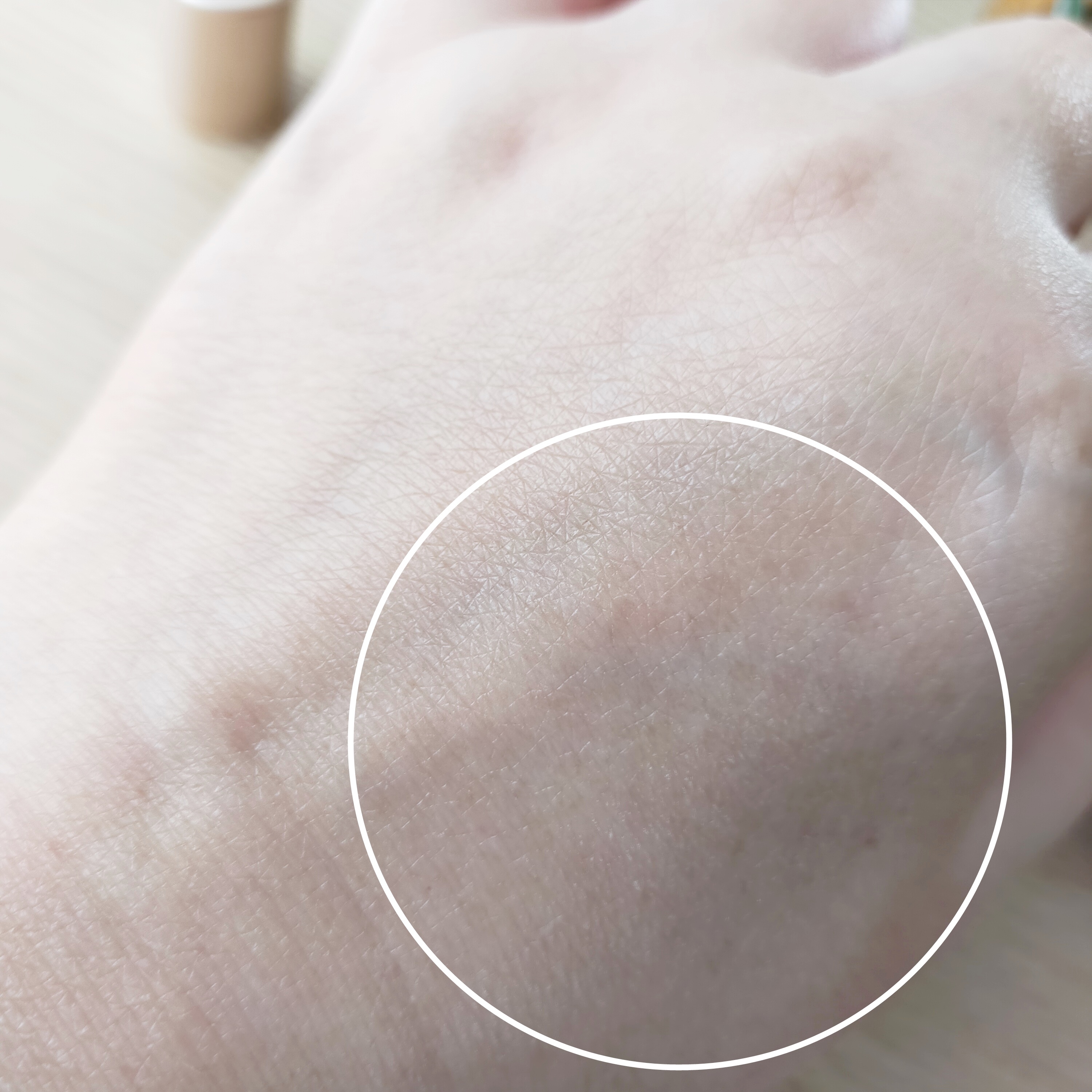 Dr.Oracle レチノタイトニング クリームのクチコミ「次世代レチノイド成分「ヒドロキシピナコロンレチノアート」と「アデノシン」を配合。


コ.....」（3枚目）