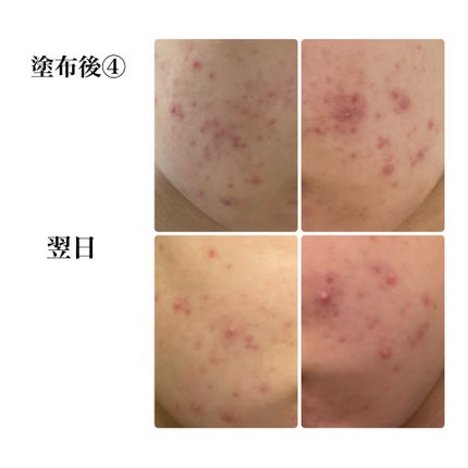 CICA スリーピングマスク/VT/シートマスク・パックを使ったクチコミ(2枚目)