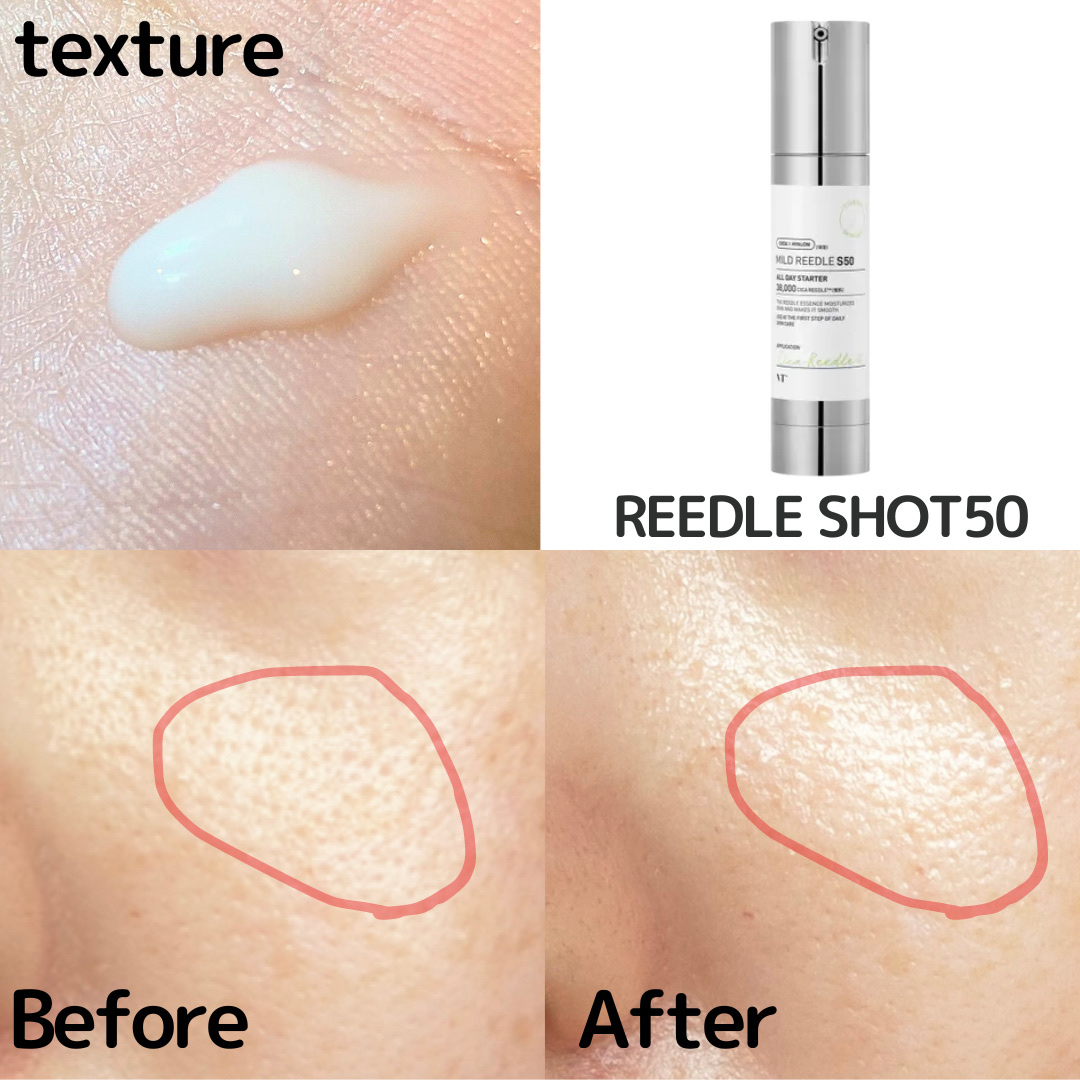 CICA デイリースージングマスク/VT/シートマスク・パックを使ったクチコミ（2枚目）