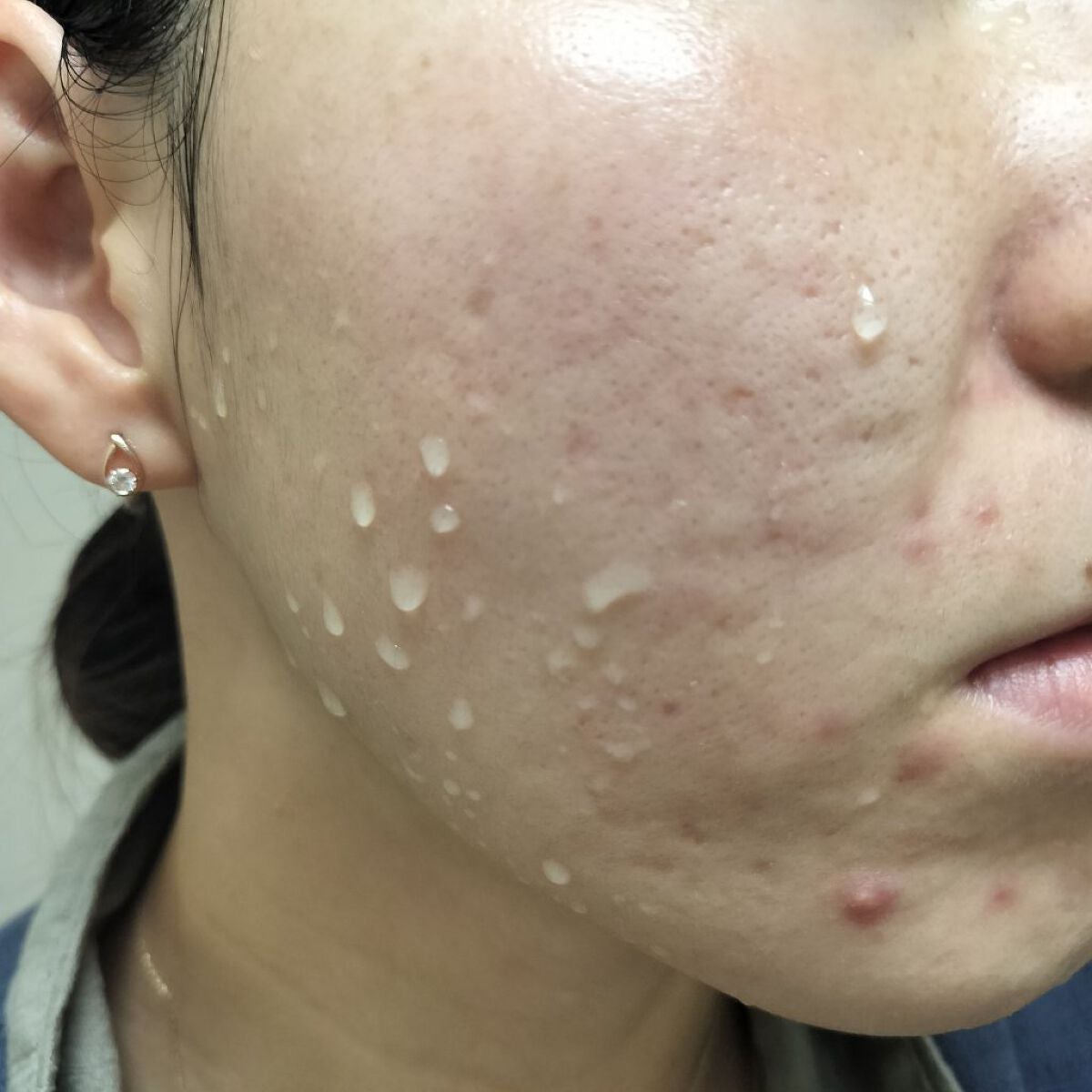 miina@汚肌工事録⚠️ on LIPS 「✍11/28㈪の#汚肌工事録ありがとう💕きょうもおつかれさまで..」(1枚目)