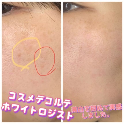 ホワイトロジスト ブライト コンセントレイト/DECORTÉ/美容液を使ったクチコミ(1枚目)