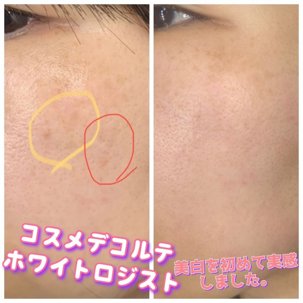 コスメデコルテ ホワイトロジスト ブライト コンセントレイト 60ml