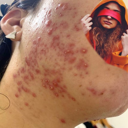 美容原液 オパール R-III/薬用 オパールR-Ⅲ/美容液を使ったクチコミ(2枚目)