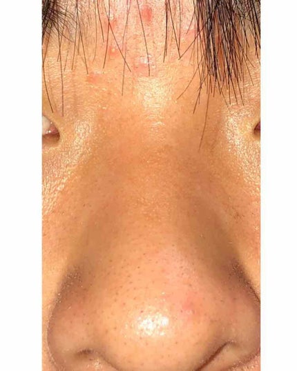 乳液・敏感肌用・高保湿タイプ/無印良品/乳液を使ったクチコミ(2枚目)