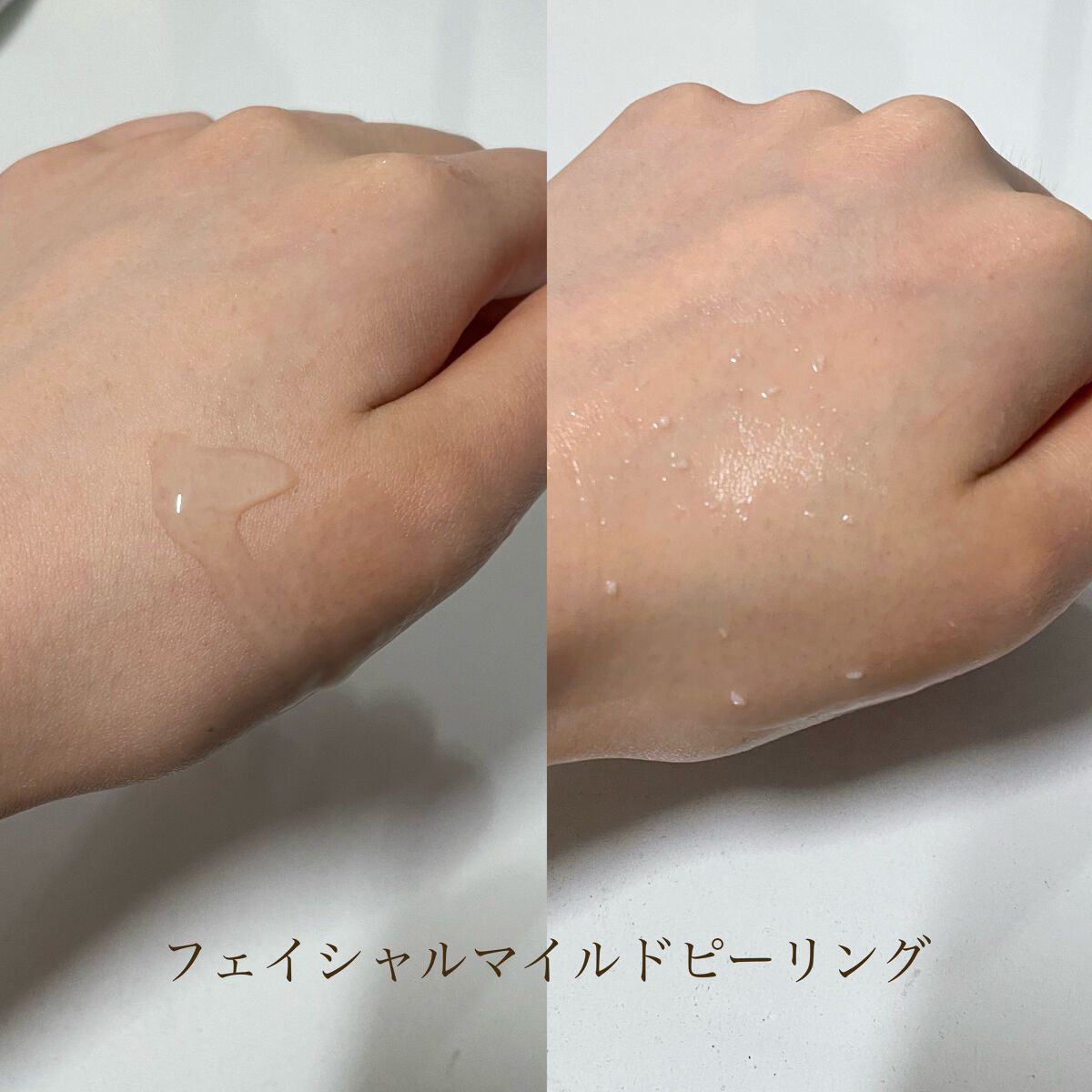 フェイシャルマイルドピーリング/primera/ピーリングを使ったクチコミ（2枚目）