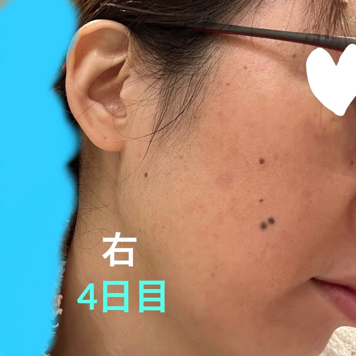 デイリーPD/ZO Skin Health/フェイスクリームを使ったクチコミ(1枚目)