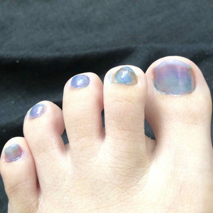 サンリオネイル/DAISO/マニキュアを使ったクチコミ(2枚目)