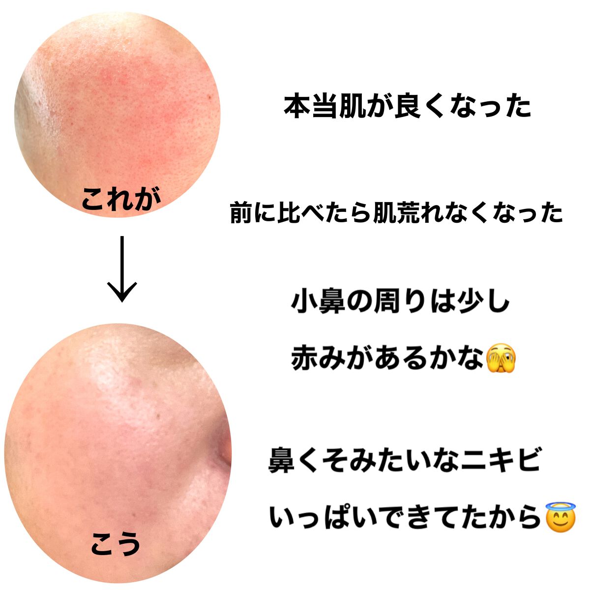 ドクダミ 77 スージングトナー/Anua/化粧水を使ったクチコミ（3枚目）